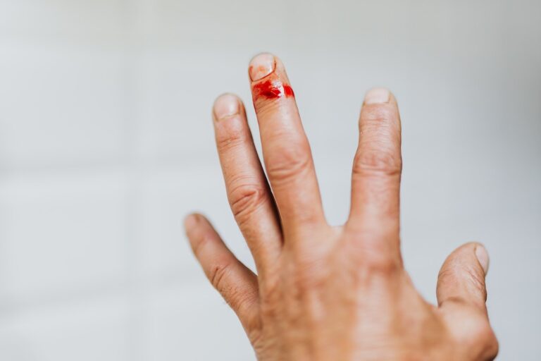 Crop unrecognizable male back hand bleeding from cut finger wound against white blurred wall