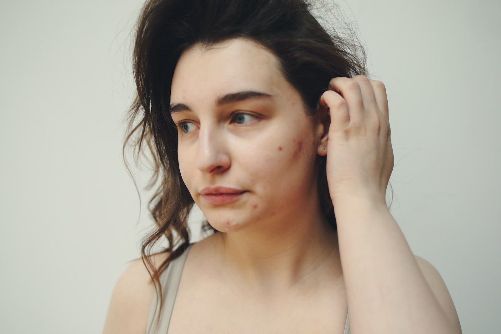 Portrait of a Woman With Acne
